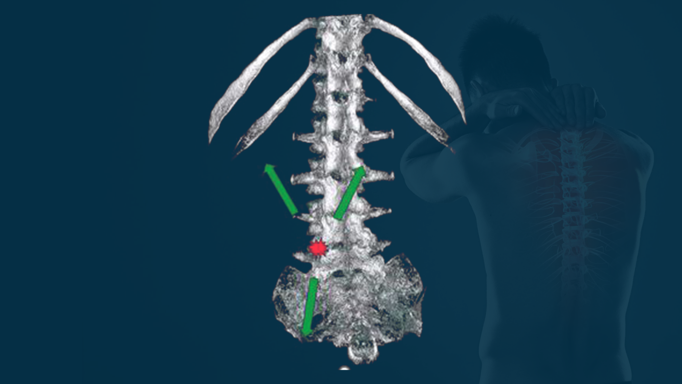mechanical concept of the Extrength