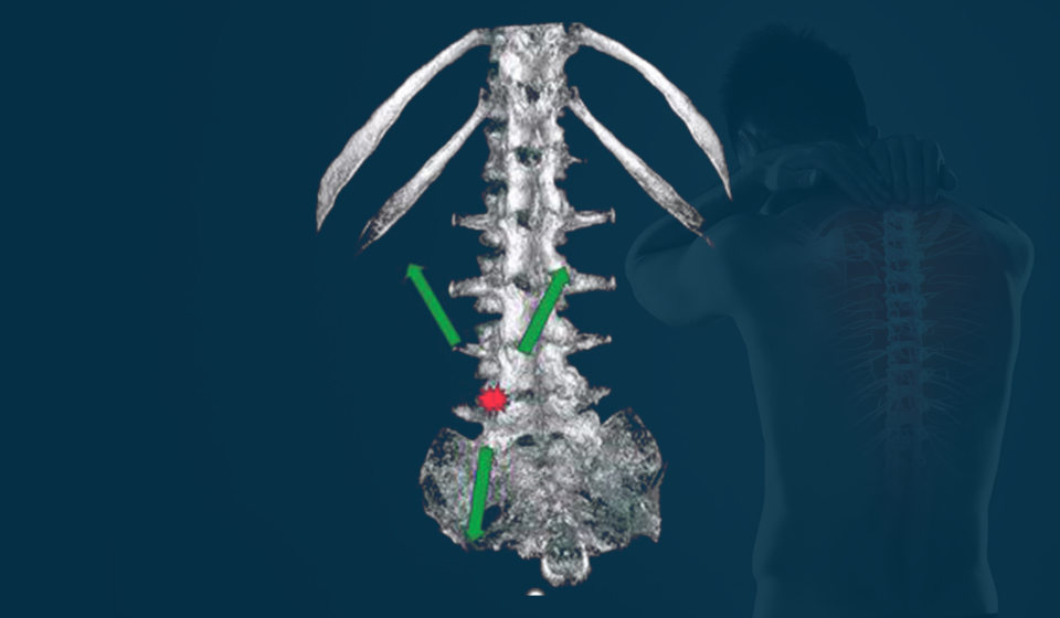 mechanical concept of the Extrength