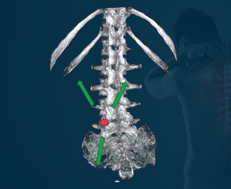 mechanical concept of the Extrength